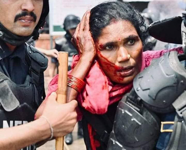 ४ किसान संगठनद्वारा प्रहरी दमनको बिरोध, मानबाधिकार आयोगको ध्यानाकर्षण